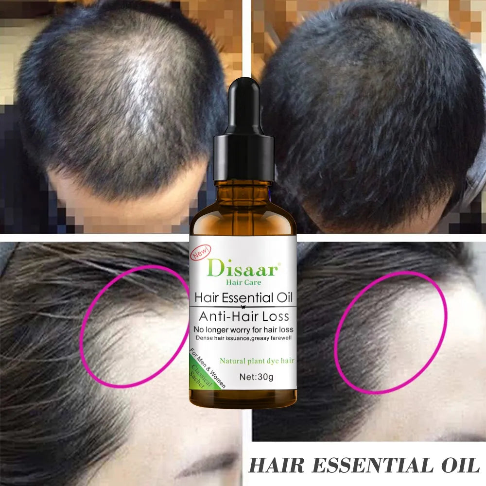 ACEITE  ANTICAIDA  HAIR CARE