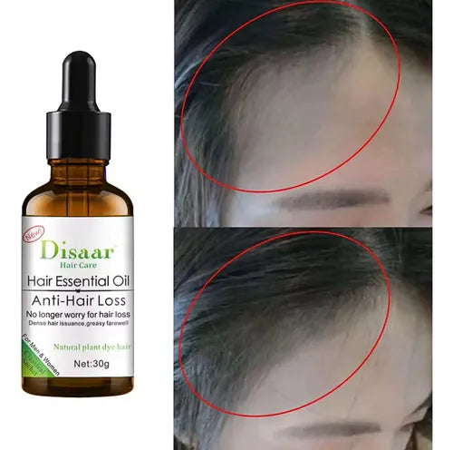 ACEITE  ANTICAIDA  HAIR CARE